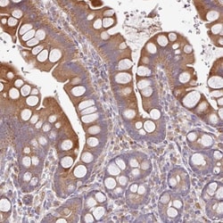 ZNF266 Antibody, Novus Biologicals 25 &mu;L; Unlabeled:Antibodies, Polyclonal
